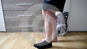 European man first steps after Achilles tendon rupture operation shows wound suture in the hospital showing stitches and operation