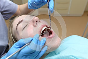 A European young woman sits in a medical chair while a dentist treats her teeth in a dental clinic