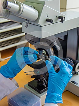 Examine in the laboratory under a microscope. Selective focus.