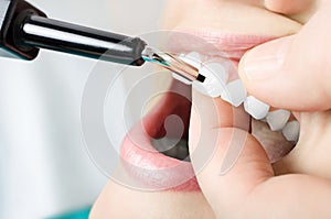 Examine the teeth vitality. Close up