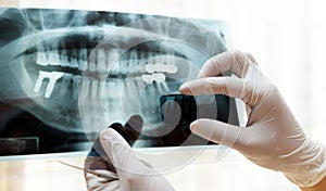 examining a panoramic dental x-ray