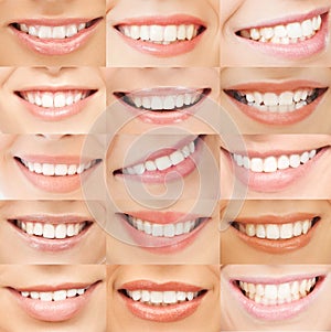 Examples of female smiles