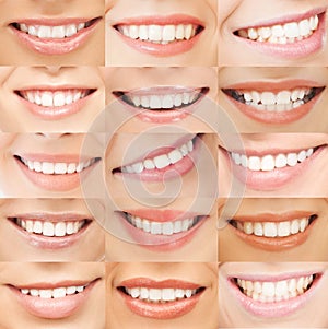 Examples of female smiles photo