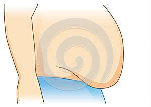 Excess abdominal fat in side view.