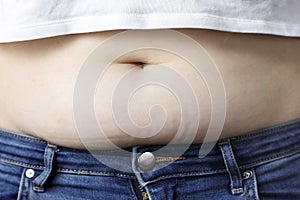 Excess fat on the abdomen close up, the concept of weight loss