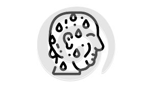 excessive sweating black icon animation