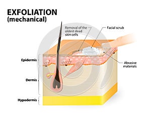 Exfoliation. cosmetology photo