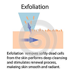 Exfoliation or Peeling, vector illustration isolated on the white background