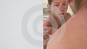 Exfoliation of the skin after sunburn. Man peeling off skin with a hand on the shoulders. The skin peels off, burnt skin