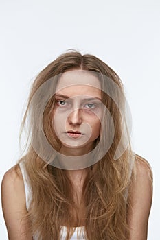 Exhausted Young Woman With Bruises Under Eyes