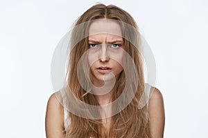 Exhausted Young Woman With Bruises Under Eyes photo