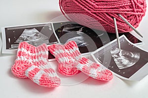 Expecting baby concept. Ultrasound pictures and knitting shoes