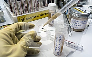 Experienced laboratory scientist analyzing a fecal sample, botulism infection in sick people