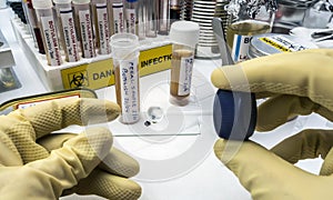 Experienced laboratory scientist analyzing a fecal sample, botulism infection in sick people