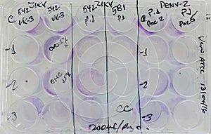 Experimental plate incubating virus infected cells culture