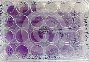 Experimental virus infected vero cells photo