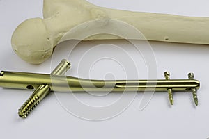 External fixation deviÑe in case of open fractures treatment