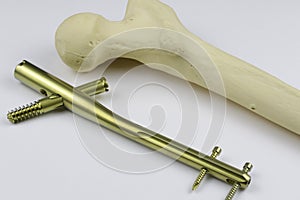 External fixation deviÑe in case of open fractures treatment