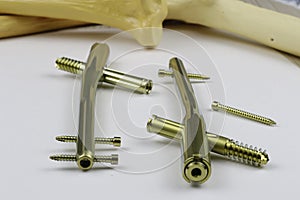 External fixation deviÑe in case of open fractures treatment