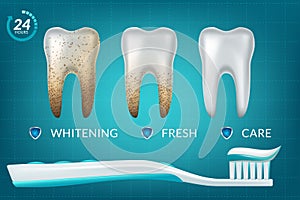 Extra Whitening Toothpaste Healthy Teeth Concept. Vector Realistic Set Illustration 3d Extruded Toothpaste, Brandname