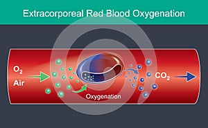 Extracorporeal Red Blood Oxygenation. Illustration