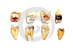 Extracted teeth on a white background