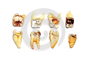 Extracted teeth on a white background photo
