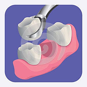 extracted tooth. Vector illustration decorative design