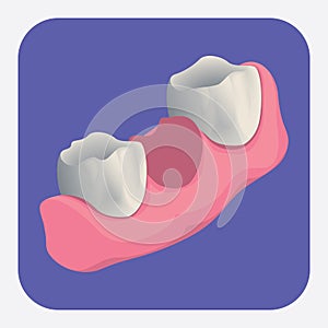 extracted tooth. Vector illustration decorative design