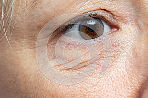 Macro detail of under eye wrinkles on middle aged woman photo