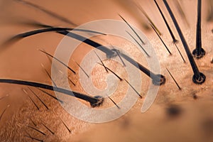 Extreme magnification - Fly face details at 20x