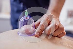 Extrime close up of of the male hand of the masseur putting vacuum healing can on the back of his client