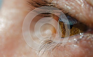 Eye