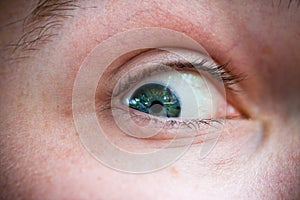 Eye