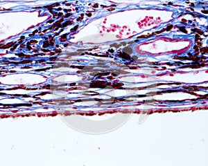 Eye. Choroid. Azan stain photo