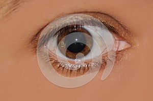 Eye with dilated pupil