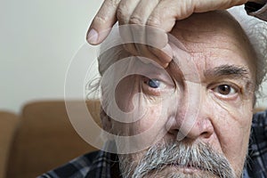 Eye disease in an old man