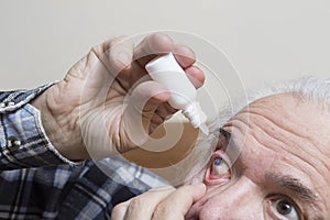 Eye disease in an old man