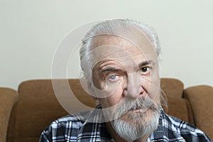 Eye disease in an old man