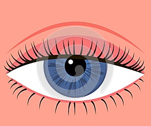 Eye with down lid. Blepharoplasty, eyelid surgery. Correction aesthetic view of eye. Vector illustration