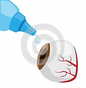 Eye drop treatment for irritation, conjunctivitis, redness and inflamation, icon in cartoon illustration vector