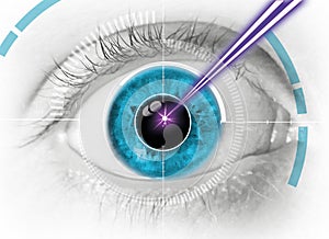 Eye laser surgery lasik icon
