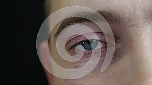 The eye of a man close-up. The man has a red eye for fatigue and stress.