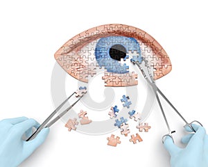 Eye operation