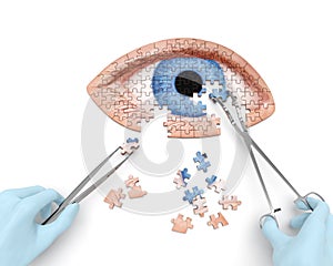 Eye operation photo