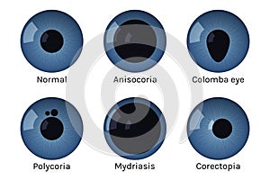 Eye pupils set with disease vector illustration