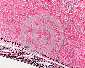 Eye. Sclera and choroid. Lamina fusca