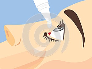 Eye treatment with eye drops