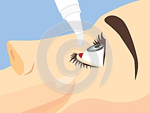 Eye treatment with eye drops photo
