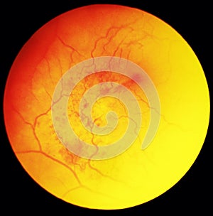 Eye under microscope photo